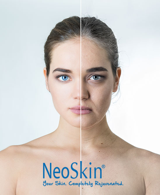 NeoSkin by Aerolase is the perfect anti-aging solution for all ages and all skin types who either want to keep their skin clear and youthful or for those that want to turn back the clock and regain a youthful complexion.
